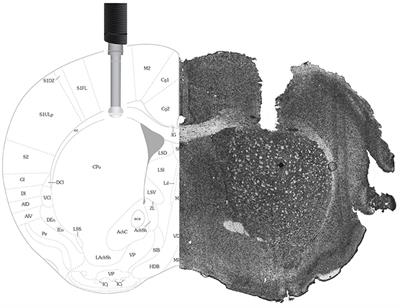 Effects of Systemic Metabolic Fuels on Glucose and Lactate Levels in the Brain Extracellular Compartment of the Mouse